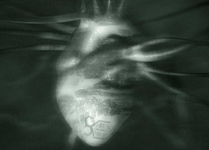replacement_heart replacement_heart